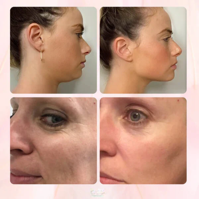 FaceGlowy™ - Gua Sha com terapia de EMS e luz